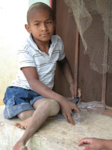 A picture of a disabled and poor kid in Honduras